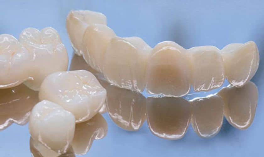 The Art of Dental Restoration: Exploring Porcelain Crowns - Old Settlers Dental - Round Rock Dentist
